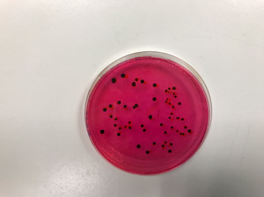 <p><em>Salmonella</em> en el yogur vista desde el microscopio. / Fundación Descubre</p>