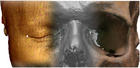 Vista de un TAC facial y de la imagen tridimensional de un cráneo.