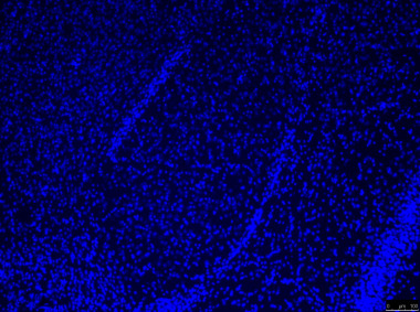 <p>Imagen de microscopía de una amígdala de ratón.<br>/ UPF</p>