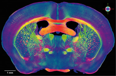 La  magnetoencefalografía permite estudiar la conectividad funcional entre distintas áreas cerebrales. / UPM