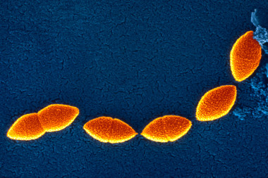 <p>Neumococo (<em>Streptococcus pneumoniae</em>). Foto: Sanofi Pasteur (CC 2.0)</p>