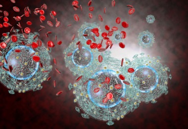 El VIH daña el sistema inmunitario mediante la destrucción de los glóbulos blancos que combaten las infecciones. / Adobe Stock