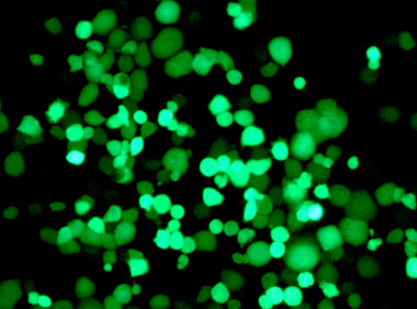 <p>Células tumorales infectadas por el virus (fluorescente) cinco días después de la infección. / Idibaps-IRB Barcelona</p>