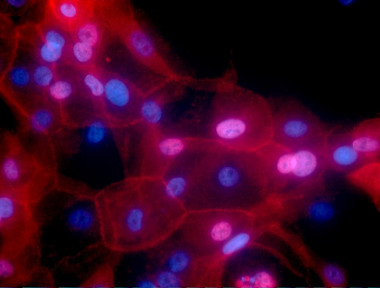 <p>Células de cáncer de mama cultivadas en laboratorio. / <a href="https://visualsonline.cancer.gov/details.cfm?imageid=10623" target="_self">NIH</a></p>