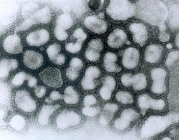 Virus H5N1 de la gripe aviar. Imagen: Wikipedia