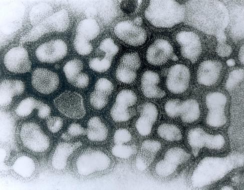 <p>Virus H5N1 de la gripe aviar. Imagen: Wikipedia</p>