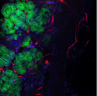 <p>Imagen de microscopía de un tumor de colon. / Alexandre Calon, IRB Barcelona</p>