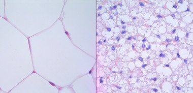 <p>(A) Tejido adiposo blanco procedente de un ratón sano. (B) Tejido adiposo transformado en marrón procedente de un ratón con cáncer, donde los adipocitos son más pequeños y los núcleos celulares más grandes que el anterior. / Michele Petruzzelli. CNIO </p>