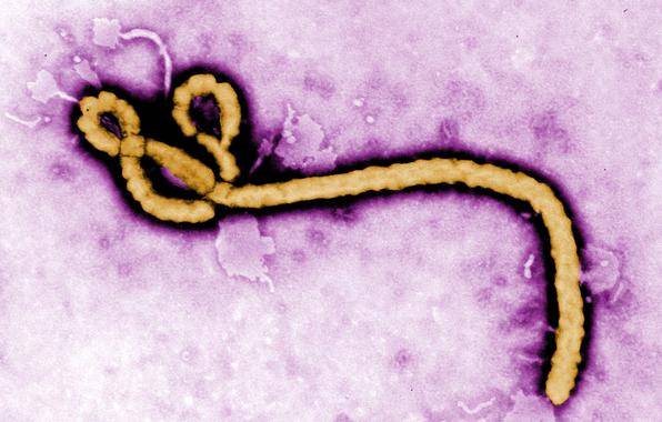 <p>Virus del ébola. / Efe</p>