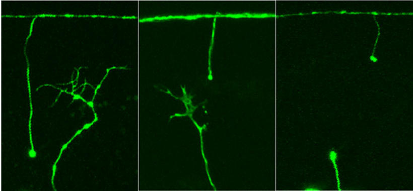 <p>Las tres fotografías muestran nervios seccionados de gusanos nematodos. Los axones -las prolongaciones de las células nerviosas- se habían estirado desde la parte de arriba hacia abajo pero fueron seccionados mediante láser. <a href="http://plataformasinc.es/index.php/esl/En-exclusiva/Imagenes-embargadas/Descubren-una-nueva-via-para-regenerar-nervios-lesionados-a-partir-de-un-gen-de-gusano" target="_self">Imagen: Universidad de Utah</a>.</p>