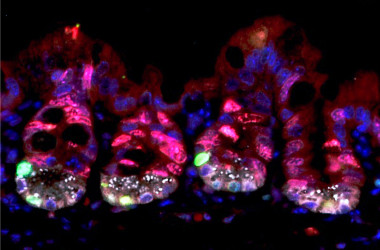 <p>En rojo, las células altamente proliferativas de las criptas intestinales, que se consideran sensibles a la radiación, son afectadas por ella y mueren durante la radioterapia. En verde, células madre durmientes con altos niveles de proteína URI, que se vuelven proliferativas tras la radiación para regenerar el intestino dañado. / CNIO</p>