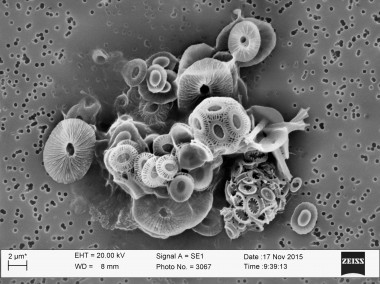 <p>Muestra al microscopio de cocolitóforo recogida en el Atlántico Norte. / Amy Wyeth- Bigelow Laboratory for Ocean Sciences</p>