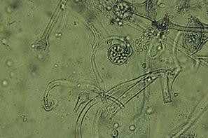 <p><em>Mucor circinelloides </em>al microscopio<em> / Wikipedia</em></p>