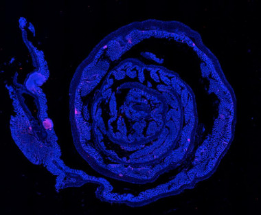 <p>Sección de colon de ratón con cáncer de colorectal, en el que se pueden visualizar los núcleos celulares (azul) y los linfocitos T (rosa). / Paloma del Reino /CNB</p>