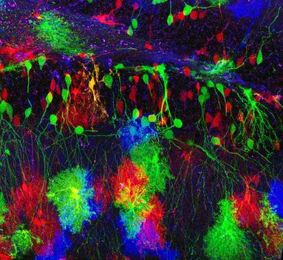 <p>El cerebro distingue al humano como una especie única. En la imagen, <a href="http://www.plataformasinc.es/index.php/esl/En-exclusiva/Imagenes-embargadas/Identifican-el-gen-que-regula-el-desarrollo-del-cerebro-humano" target="_self">células gliales y neuronas</a>. Foto: Jean Livet.</p>