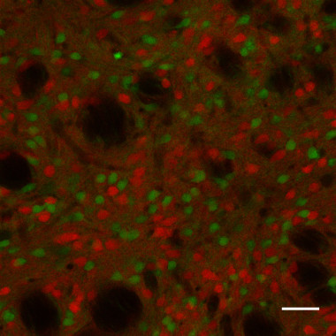 <p>Neuronas implicadas en los circuitos cerebrales que rigen los hábitos en un cerebro de ratón. Contrariamente a los colores de un semáforo, las neuronas del cuerpo estriado que indicarían el ‘go’, están manchadas de color rojo, y las neuronas de ‘stop’ aparecen verde. / Kristen Ade, Universidad de Duke </p>