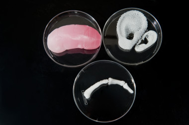 <p>Un riñón, un dedo y una oreja imprimidos en 3D. / Wake Forest Institute</p>