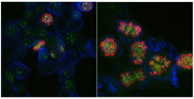 <p>Las células haploides consiguen dividirse en presencia del compuesto DAB (izquierda) mientras que aquellas que tienen un mayor número de cromosomas no son capaces de hacerlo (derecha). Como consecuencia, las células haploides sobreviven en presencia de DAB mientras que las que tienen un mayor número de cromosomas terminan por desaparecer en cultivos de laboratorio. / CNIO</p>