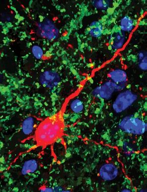 <p>En color verde, las nuevas conexiones neuronales del ratón tras una ceguera simulada. / Emily Petrus </p>