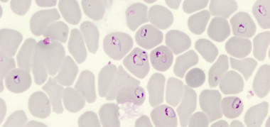 <p>Anillos de <em>Plasmodium falciparum</em> al microscopio / ISGlobal</p>