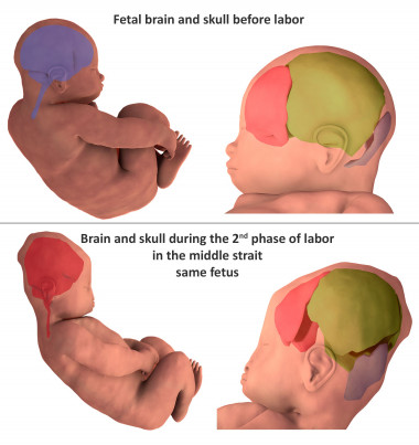 <p>Reconstrucción tridimensional de los huesos craneales antes del parto y durante la segunda parte del mismo. / Ami et al</p>