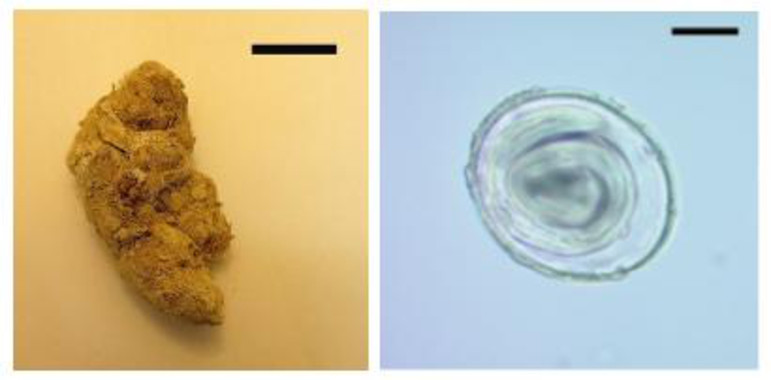 <p>Imagen del coprolito (izquierda) y los huevos de <em>Toxascaris leonina</em> encontrados (derecha). / Romina S. Petrigh, Jorge G. Martínez, Mariana Mondini y Martín H. Fugassa</p>