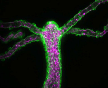 <p>La <em>Hydra vulgaris</em> es la especie que se ha utilizado para realizar la investigación. En la imagen se pueden observar capas de tejido externa e interna (en verde y magenta, respectivamente) a una escala de 200 micrómetros. / Callen Hyland</p>