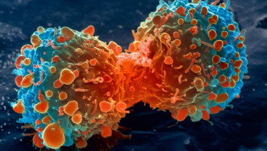 <p>Célula tumoral de pulmón en plena división. / <a href="https://www.cancer.gov/about-cancer/understanding/what-is-cancer" target="_blank">NIH</a></p>