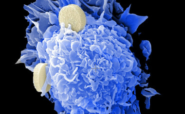 <p>Estos son los protagonistas de las nuevas nanovacunas para la terapia del cáncer. En azul, las células dendríticas y en blanco, las nanovacunas, cargadas con moléculas inmunoestimulantes y antígenos tumorales. Las células dendríticas, activadas por las vacunas, se inyectan en el paciente para estimular una respuesta contra el cáncer. Imagen: <a href="https://visualsonline.cancer.gov/details.cfm?imageid=10884" target="_blank">NCI</a></p>