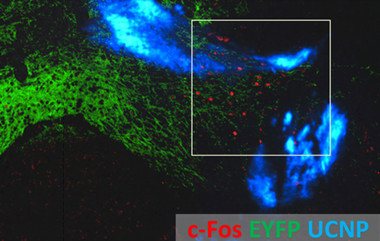 <p>Activación no invasiva de las neuronas en el centro de recompensa del cerebro del ratón, usando proteínas flourescentes g-Fos y EYFP y nanopartículas UCNP. / Dr. Shuo Chen y Dr. Thomas J. McHugh</p>