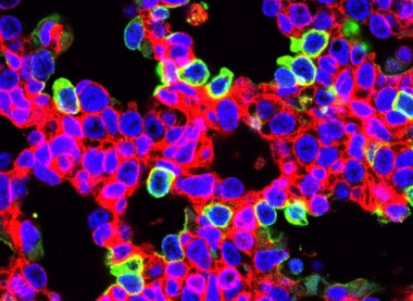 <p>Células pulmonares editadas por CRISPR (verdes) durante la investigación/ Ed Morrisey, Penn Medicine</p>