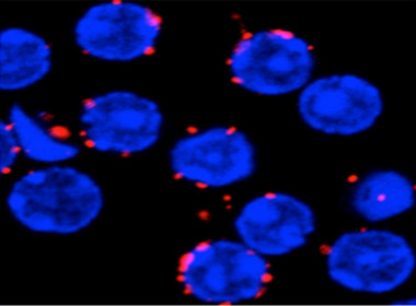 <p>Los investigadores han descubierto un modelo idóneo para el estudio de autoinmunidad causada por la incompleta activación de los linfocitos B (en azul en la imagen de microscopía confocal). / Kathrin Kläsener</p>