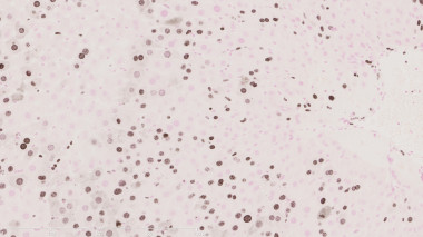 <p>Hígado en plena proliferación celular. Según el estudio, la proteína p38ɣ es clave en el inicio de la división en las células hepáticas. / CNIC</p>