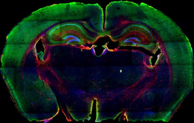 <p>Expresión de CAS9 (verde) y GFAP (rojo) en una sección coronal del cerebro de un ratón TVA/Cas9. / CNIO</p>