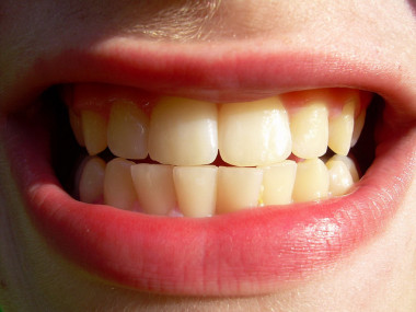 <p>La oclusión dental es el contacto que se establece entre los dientes superiores e inferiores al cerrar la boca. / <a href="https://www.flickr.com/photos/eltpics/9364940645/sizes/z/" target="_blank">Eltpics</a></p>