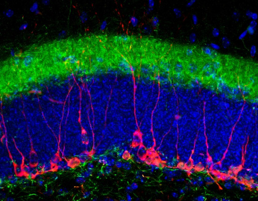 Tinción de marcadores neuronales estudiados en el del hipocampo de un ratón macho adulto. / Kerry R. McGreevy.