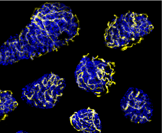 islotes pancreáticos