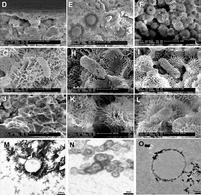 nanohaloarchea_dallol_fig2