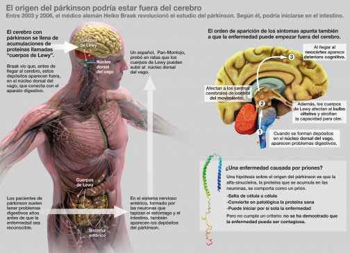 parkinson