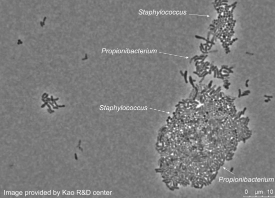 The-mixed-cultured-Propionibacterium-and-Staphylococcus-under-microscope-02