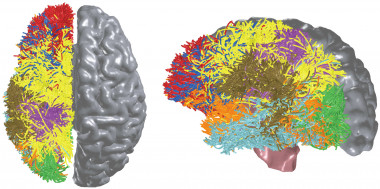 <p>BlueMatter es un algoritmo, creado por IBM y la Universidad de Stanford, para medir y mapear de forma no invasiva las conexiones corticales y subcorticales del cerebro. / IBM Research.</p>