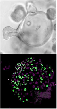 <p>En placas de laboratorio, las células madre intestinales generan unos organoides esféricos (panel superior) que bajo el microscopio (panel inferior) revelan estar formados mayoritariamente por células indiferenciadas y proliferativas, las células madre intestinales (en verde). Imagen: IRB</p>