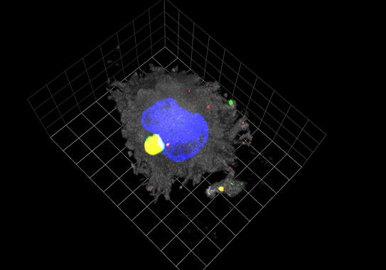 <p>Reconstrucción tridimensional de una célula dendrítica madura (en gris) donde el VIH (en rojo) se almacena con el nuevo receptor identificado, Siglec-1 (en verde). Imagen: IrsiCaixa</p>