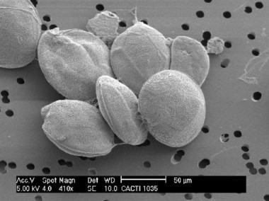 <p>Vista al microscopio de la microalga tóxica productora de ciguatoxinas. Imagen: IEO</p>