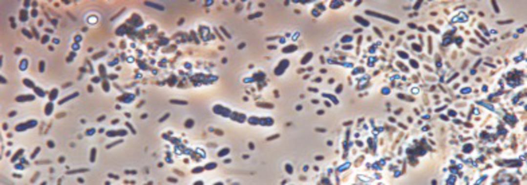 <p>Muestra de microbiota de heces humanas. / CSIC</p>
