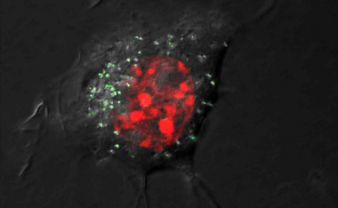 <p>Imagen al microscopio de una célula con nanopartículas de plata con fluorescencia verde y núcleo teñido de rojo. / MPIKG</p>