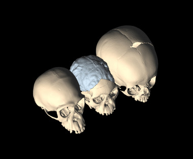 <p>Imágenes del cráneo obtenidas por escáner. Imagen: M. Ponce de León y Ch. Zollikofer.</p>