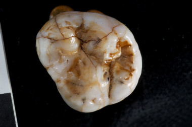 <p>Uno de los molares descubiertos en la cueva Denisova (Siberia) en 2010. Imagen: Instituto Max Planck de Antropología Evolutiva.</p>