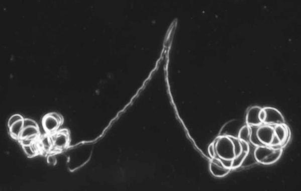 <p>El esperma del escarabajo presenta una gran variedad de formas y estructuras. Imagen: Dawn Higginson/ Universidad de Arizona</p>