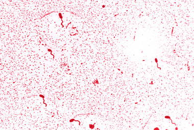 <p>Bacterias marinas <em>Vibrionaceae cholerae</em><em>.</em> Imagen: <a href="http://upload.wikimedia.org/wikipedia/commons/d/db/Vibrio_cholerae_01.jpg?uselang=es" target="_blank">Wikipedia.</a></p>